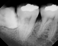 teeth20061106.JPG